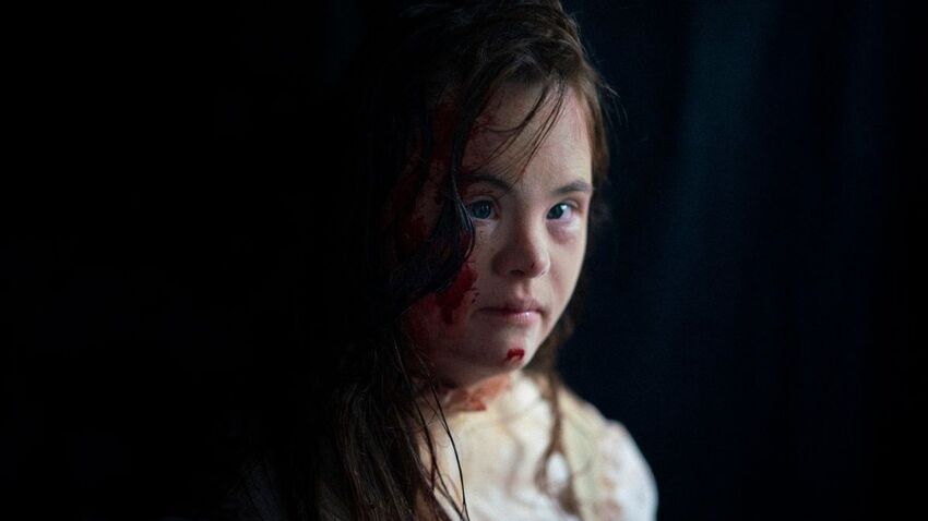 A person with long dark hair looks at the camera. It is a shadowy image, and the side of her face is covered in blood